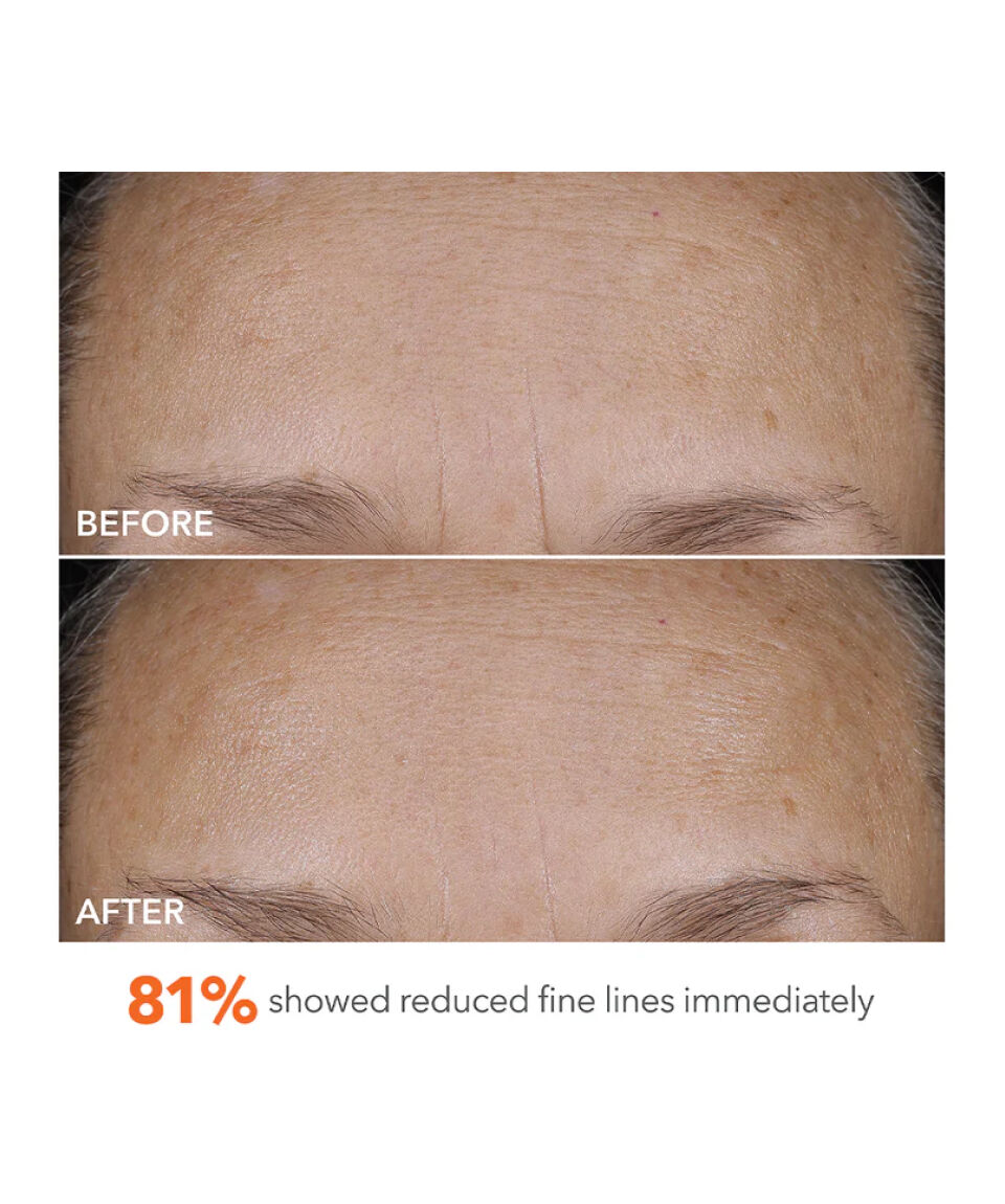 Display Product shot 6 of Blur + Repair Moisturizer Cream with Hyaluronic Acid