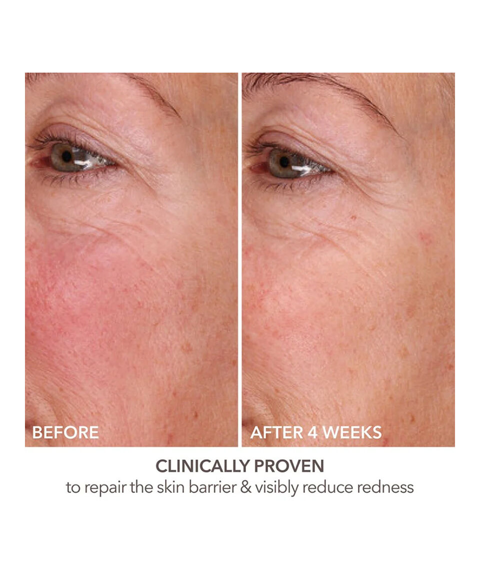 Display Product shot 6 of Fill + Repair Serum with Hyaluronic Acid