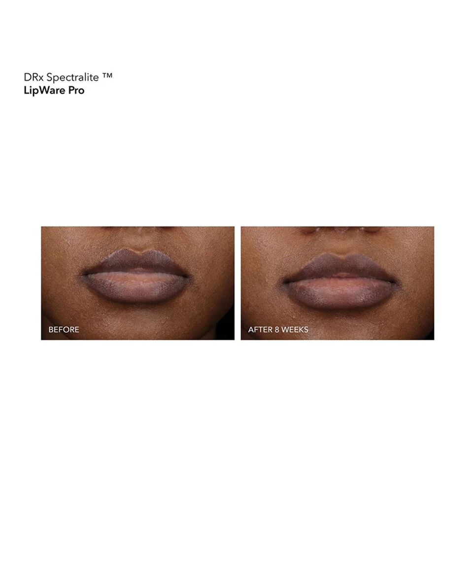 Display Product shot 6 of LipWare Pro LED Device