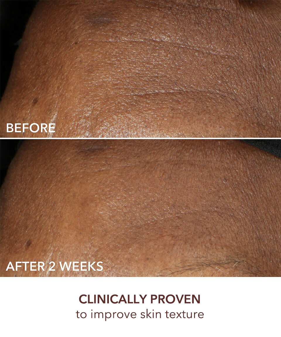 Display Product shot 4 of Intense Wrinkle Cream