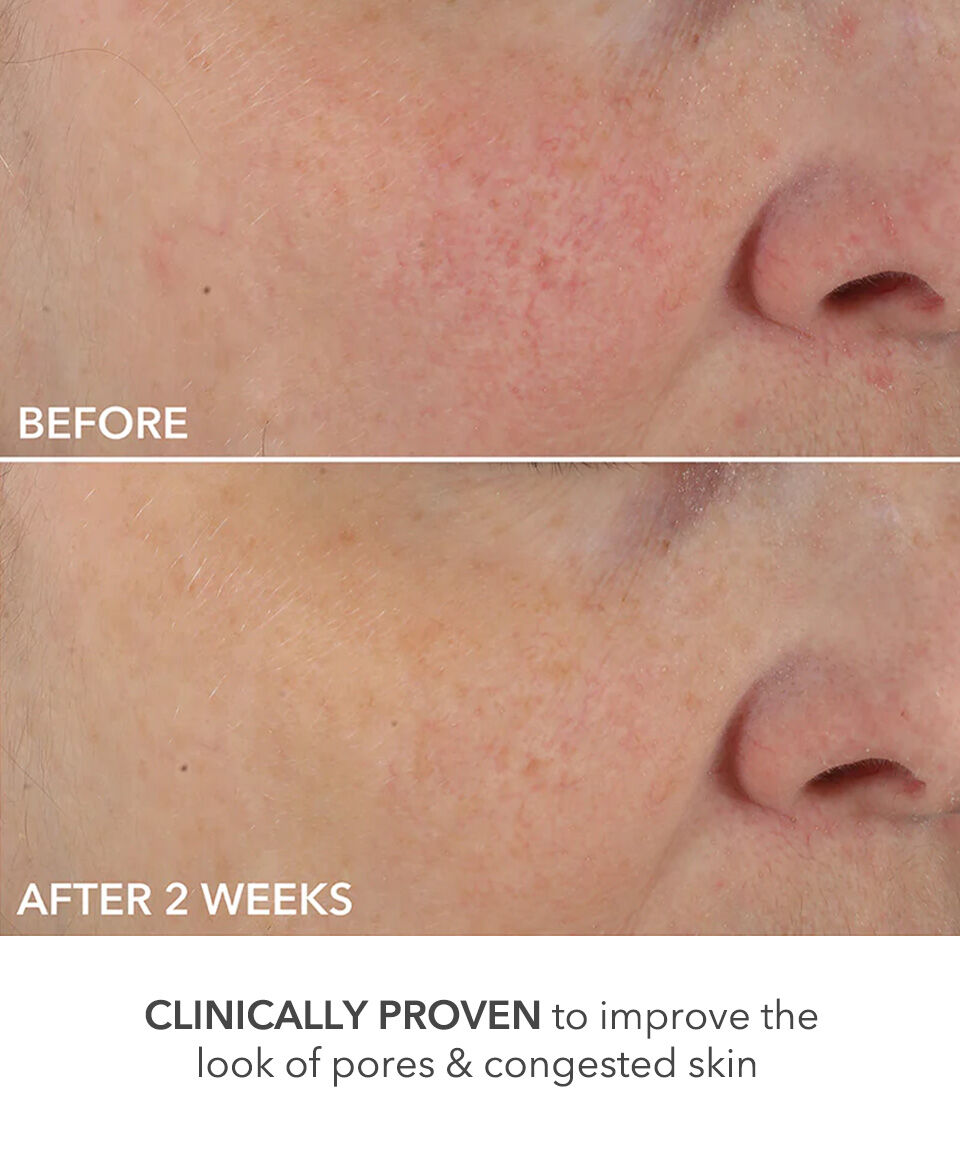 Display Product shot 6 of Perfectly Dosed Treatments (Universal 0.2%)