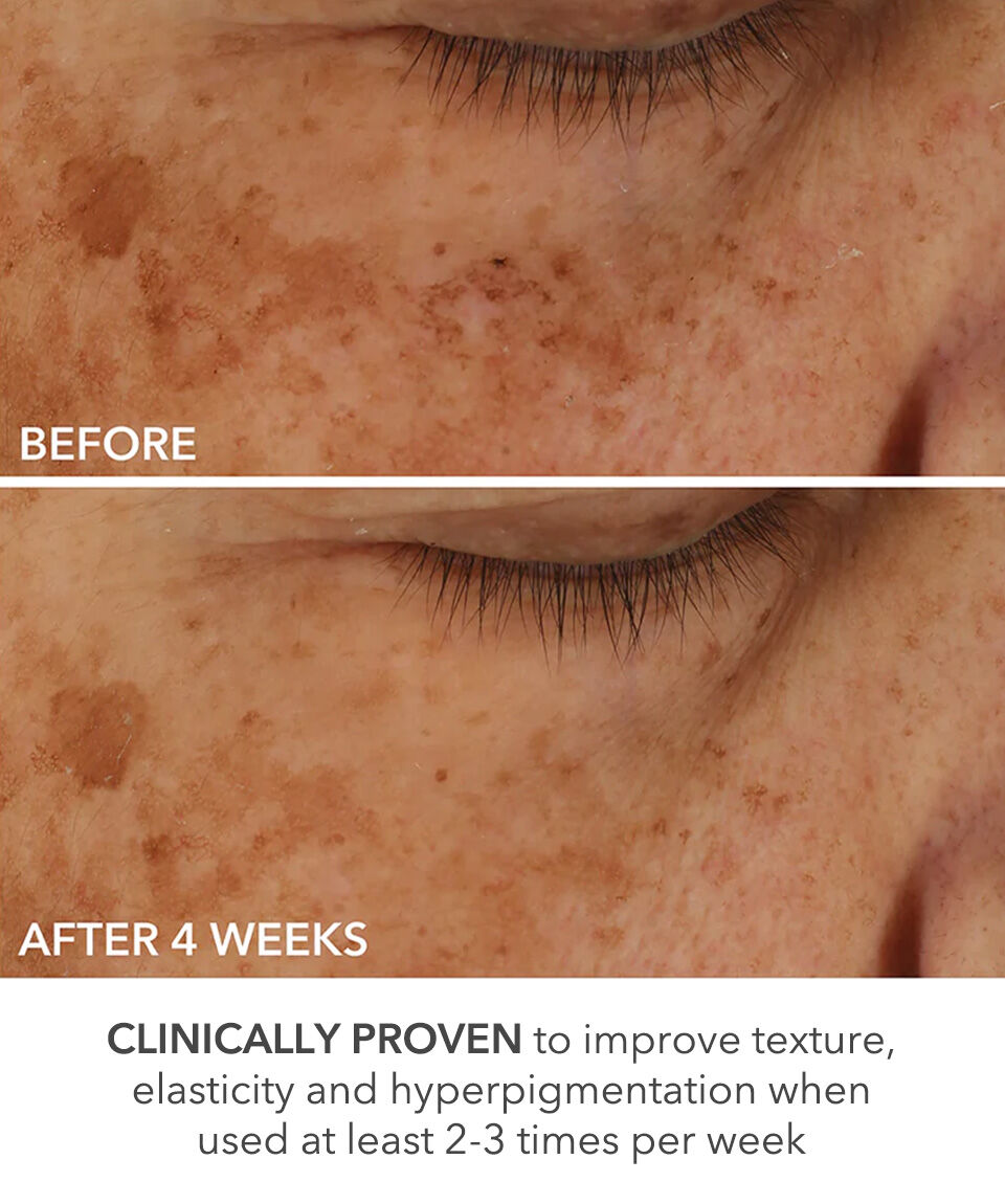 Display Product shot 7 of Perfectly Dosed Treatments (Universal 0.2%)