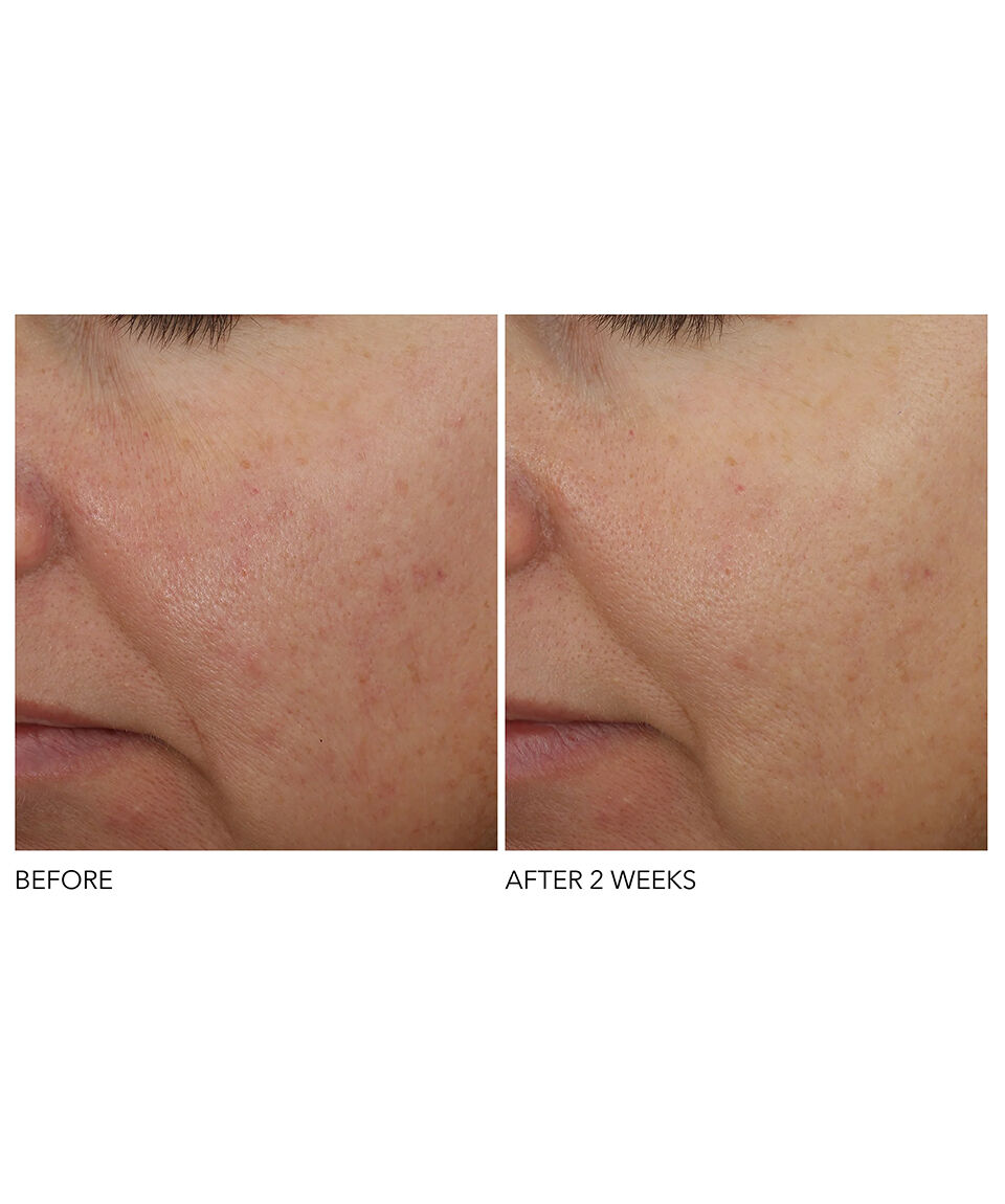 Display Product shot 7 of Overnight Wrinkle Serum Treatment