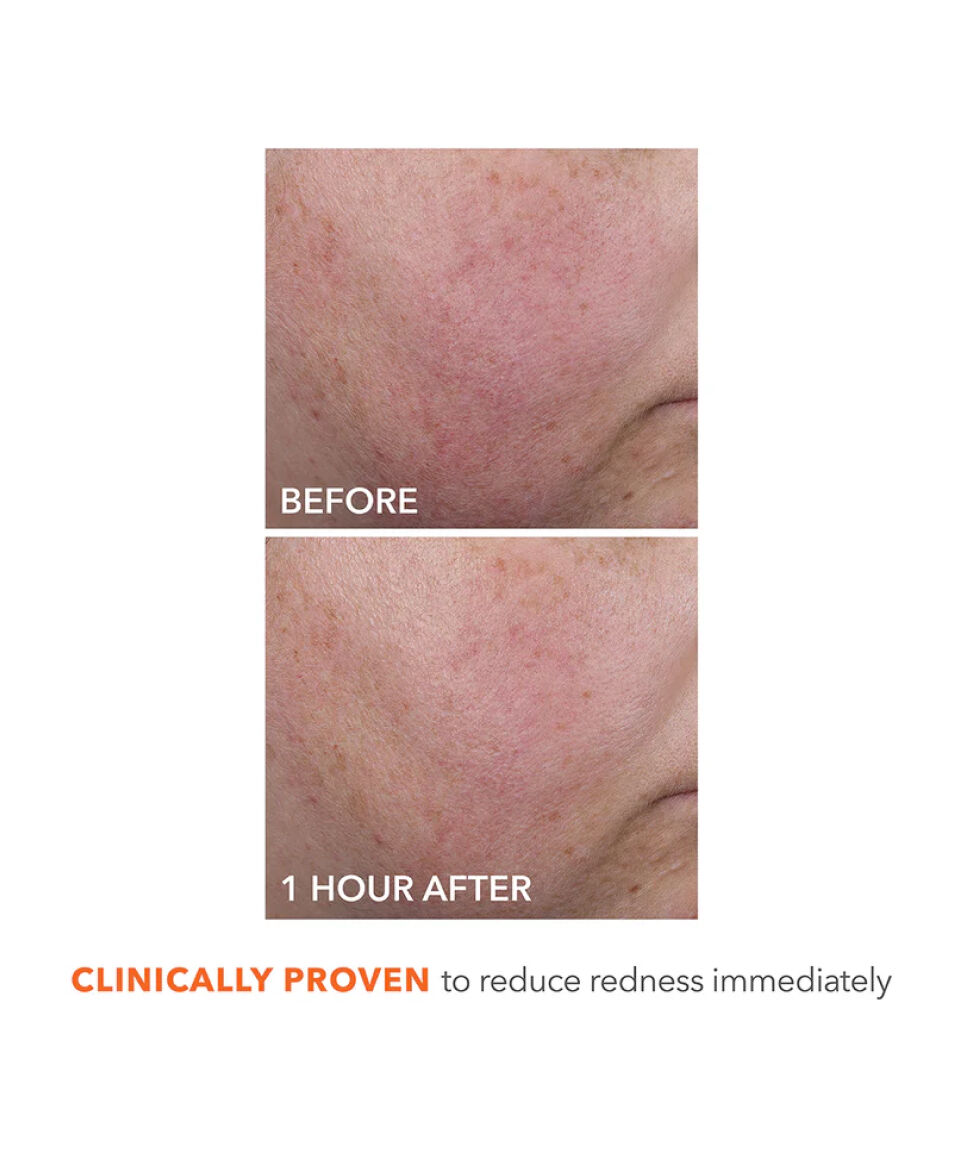 Display Product shot 5 of Blur + Repair Moisturizer Cream with Hyaluronic Acid