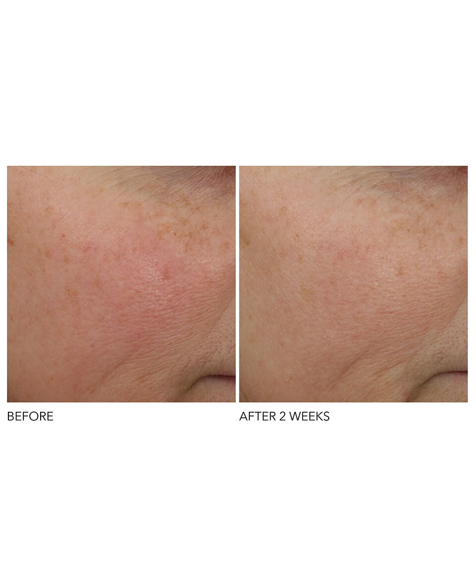 Display Product shot 5 of Overnight Wrinkle Serum Treatment