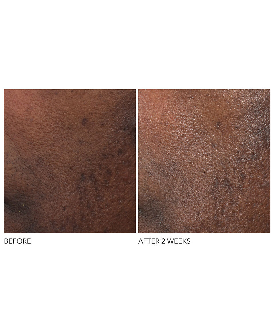 Display Product shot 6 of Overnight Wrinkle Serum Treatment