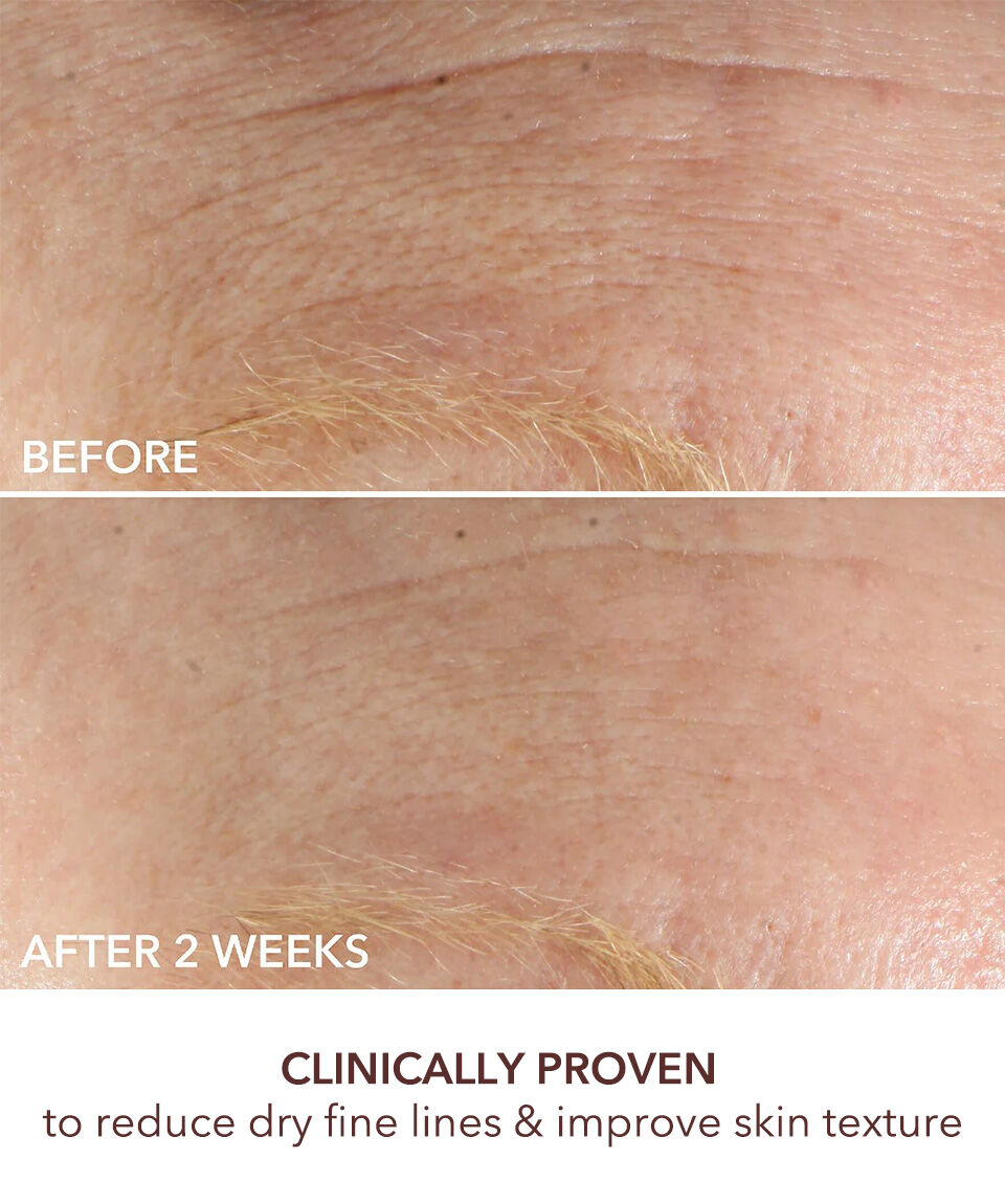 Display Product shot 5 of Intense Wrinkle Cream