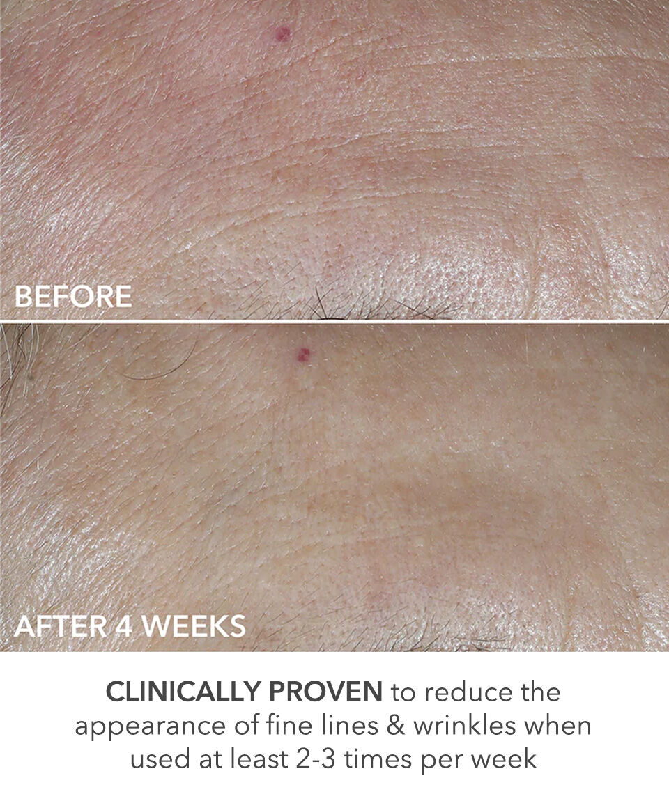 Display Product shot 5 of Perfectly Dosed Treatments (Universal 0.2%)